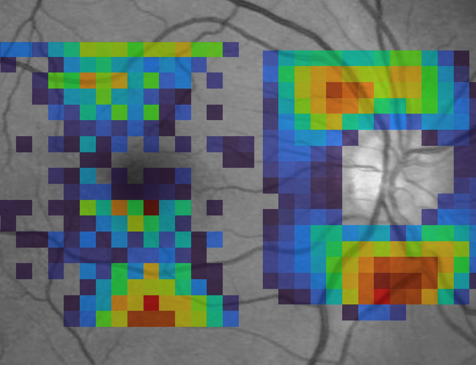 ai mapping of inner eye